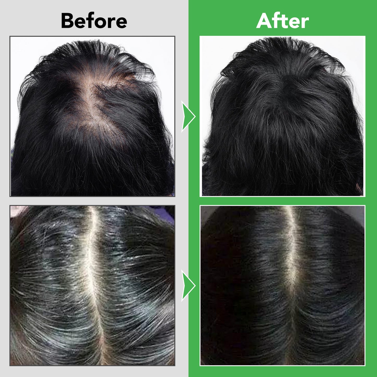 Aliver Rosemary Shampoo With Infused Biotin & Castor Oil Hair Growth Treatment