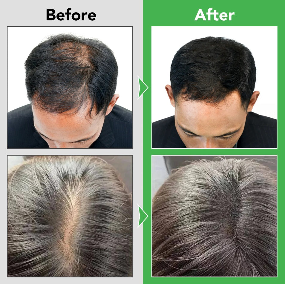 Aliver Rosemary Shampoo With Infused Biotin & Castor Oil Hair Growth Treatment