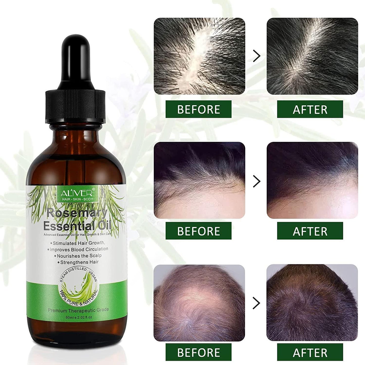 Aliver Rosemary Oil For Hair Growth - Strengthen, Nourish & Prevent Hair Loss
