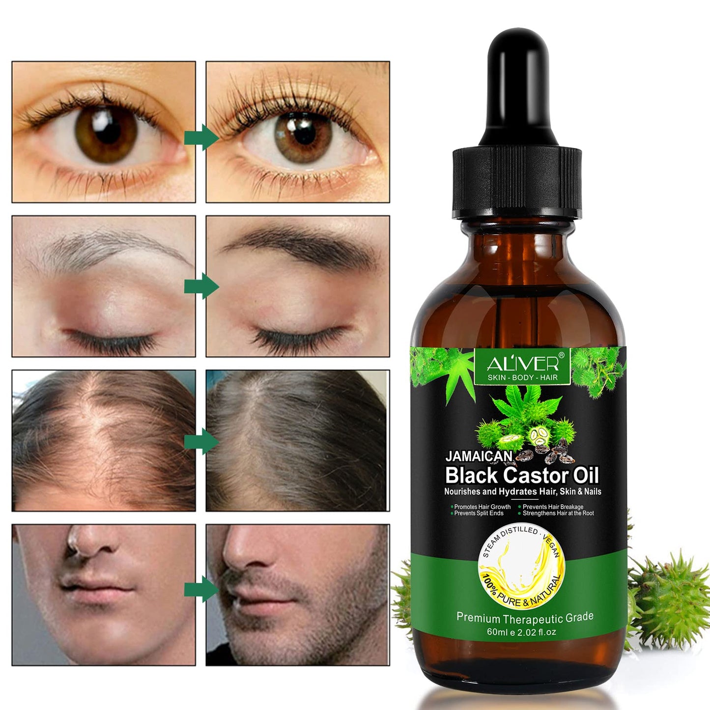 Aliver Jamaican Black Castor Oil