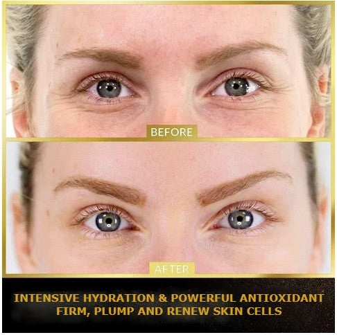 Aliver Under Eye Collagen Gold Eye Patches for Dark Circles, Eye Bags & Puffy Eyes 60 pcs