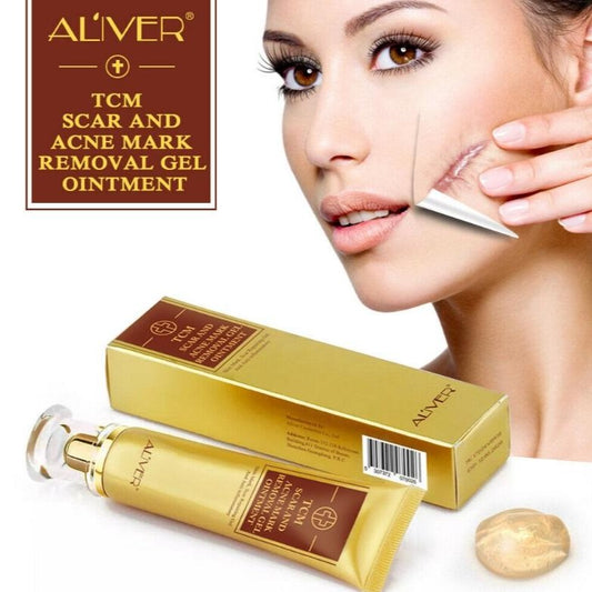 Acne Treatment And Scar Removal Cream