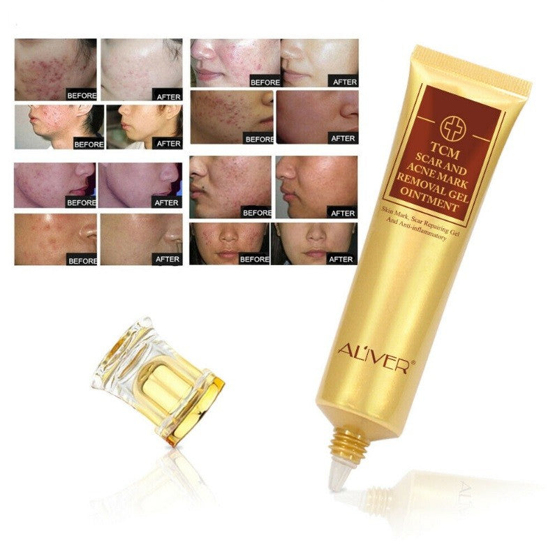 Acne Treatment And Scar Removal Cream
