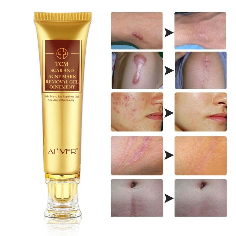 Acne Treatment And Scar Removal Cream
