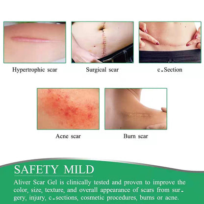 Aliver Scar Removal Tape