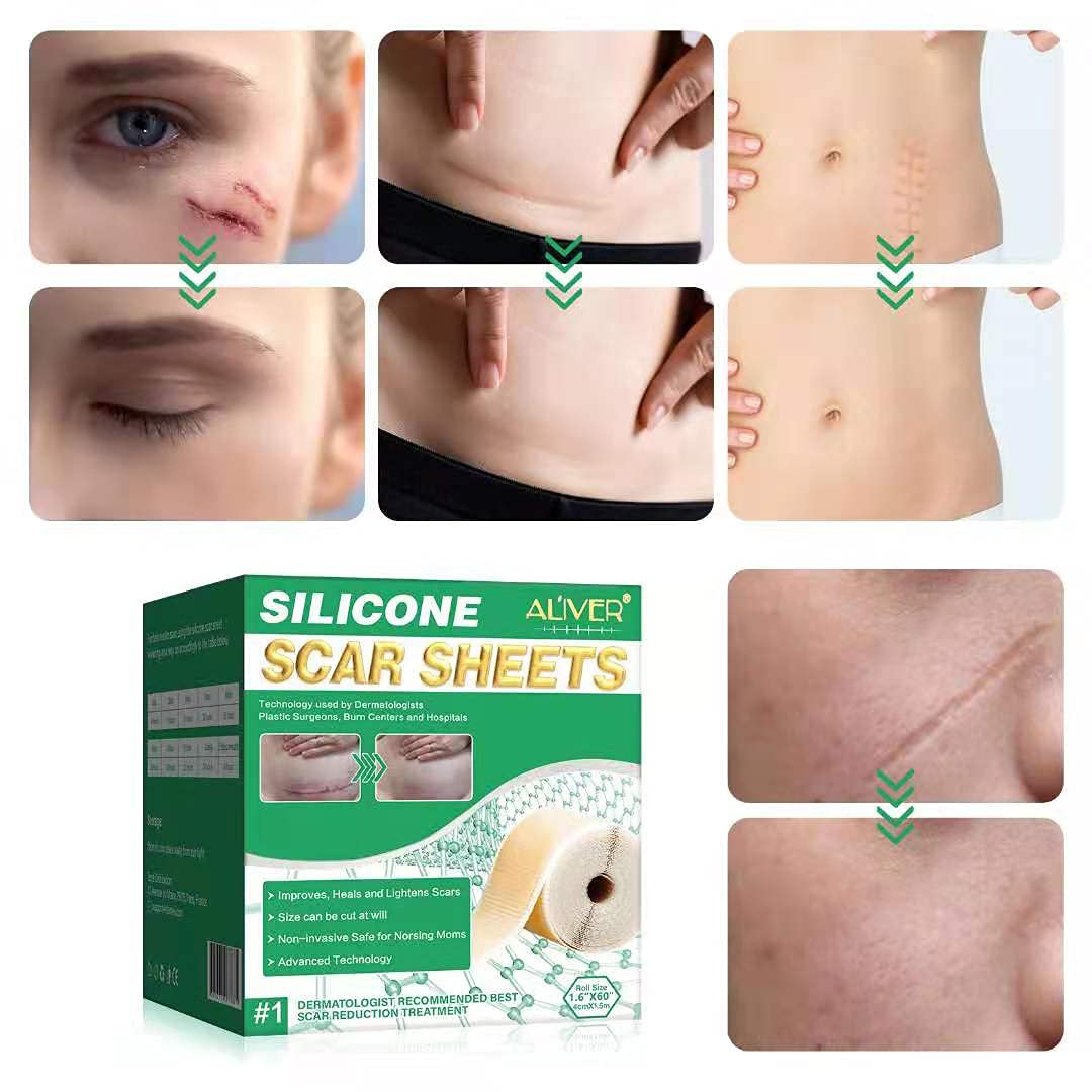 Aliver Scar Removal Tape