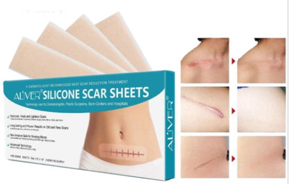Aliver Silicone Scar Removal Sheets